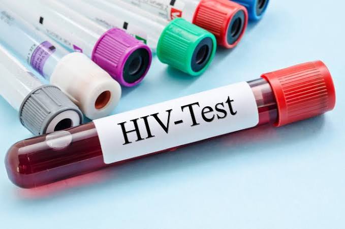 New HIV Treatment Strategy Could Permanently Clear the Virus in Infected Newborns